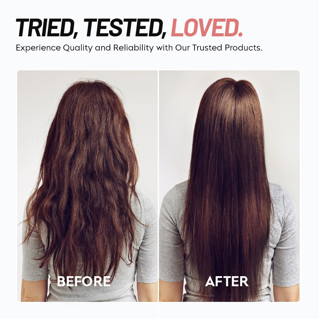 ScalpEase Self-Cleaning Hair Brush