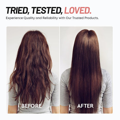 ScalpEase Self-Cleaning Hair Brush